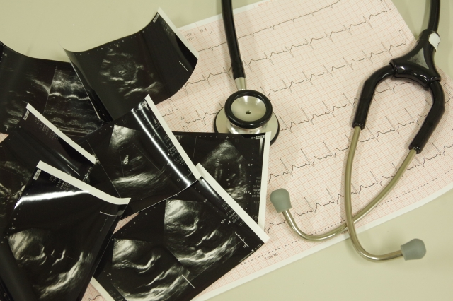 並べられた心電図、心エコー写真と聴診器