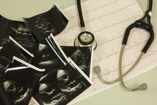 心電図用紙の上に置かれた聴診器と心エコー検査画像