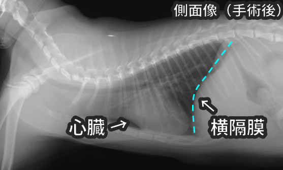 手術後の側面像のレントゲン写真