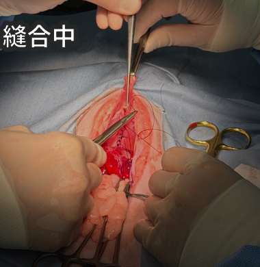 横隔膜を縫合している様子