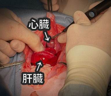 肝臓をお腹側に戻した後の写真